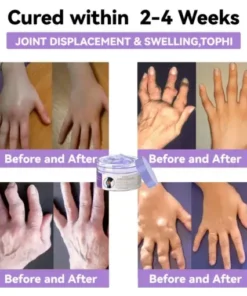 7 Day Rapid Joint & Bone Therapy Cream