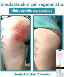 All-in-One Laser Eraser Pen