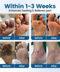 AngioVita Diabetic Care Spray