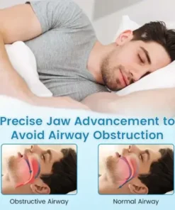 Anti-Snoring Guard