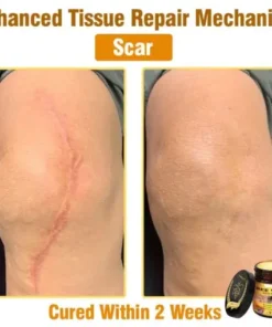 Bee Venom All-in-One Cream