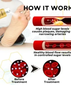Bee Venom Diabetic Foot Treatment Spray