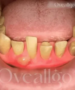 BeeRenew Advanced Gum Healing Toothpaste