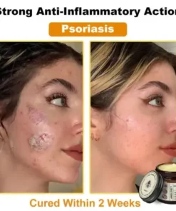 Botox Bee Venom Rapid Skin Repair Cream