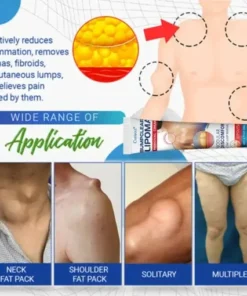 BumpClear Lipoma Removal Cream