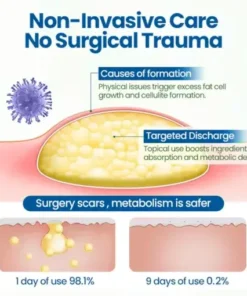 BumpClear Lipoma Removal Cream