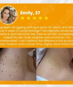 DermaErase Advanced Mole & Spot Removal Gel