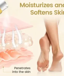 Diabetic Foot Healing Spray – Bee Venom Infused