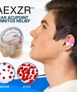 Ear Acupoint Tinnitus Relief