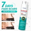 EliteAloe ScarSolve Spray
