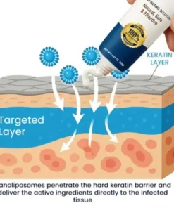 Genital Warts Remover Cream