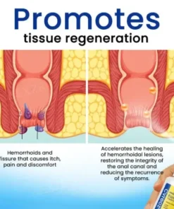 Herbal Hemorrhoids Fast-Acting Treatment Spray