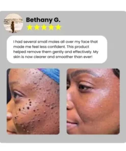 Home Use CO2 Laser Shot Erase Pro