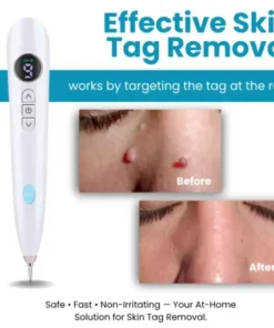 Home Use CO2 Laser Shot Erase Pro