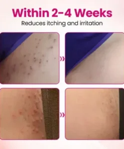 IntiDefend Anti-HPV Interferon Gel