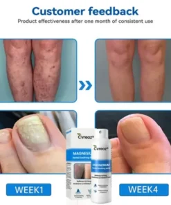 Magnesium Herbal Psoriasis Spray