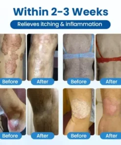 Magnesium Herbal Treatment Spray