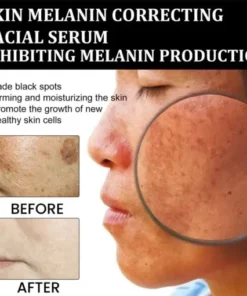 Melanin Correcting Facial Serum