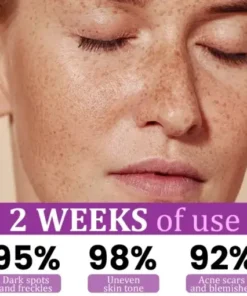 MelantraX Advanced Anti-Hyperpigmentation Essence