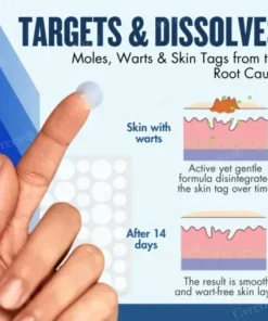 Moles & Warts Removing Skin Tag Patch