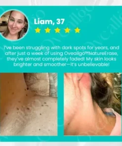 NatureErase Instant Mole & Spot Cream