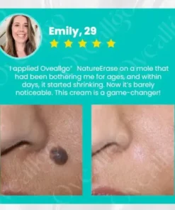 NatureErase Superior Instant Mole & Spot Removal Gel