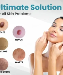 Non-Invasive Mole and Wart Removal Laser Pen