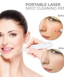 Portable Laser Spot Cleaning Pen