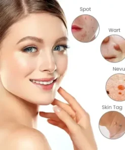 Portable Laser Spot Cleaning Pen