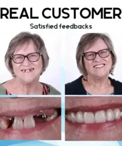 Premium Custom Silicone Denture Set