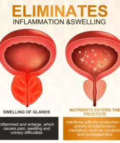 ProstaFlow Rapid Relief Nasal Spray