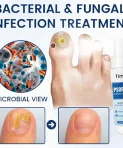 PsoriCure Magnesium Herbal Spray