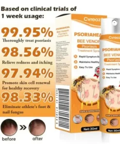 PsoriaHeal Bee Venom Psoriasis Treatment Spray
