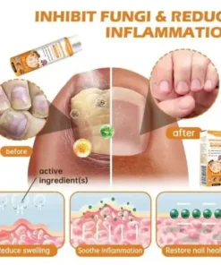 PsoriaHeal Bee Venom Psoriasis Treatment Spray