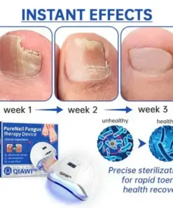 PureNail Fungus Laser Device