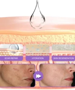 RevivaDerma Face & Body Scar Gel