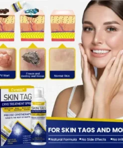 Skin Tag Cryo Treatment Spray