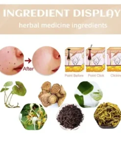 Skin Tag & Mole Remover