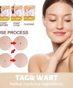 Skin Tag & Mole Remover