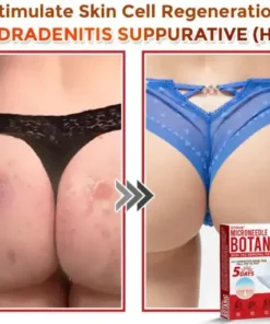 Skin Tag Removal Patch