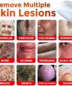 Skin Tag Removal Patch