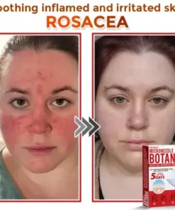 Skin Tag Removal Patch