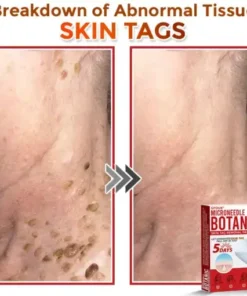 Skin Tag Removal Patch
