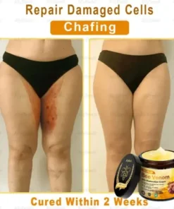 Skin Treatment Cream