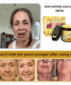 Skin Treatment Cream