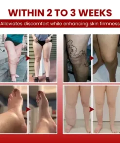 SwellCare Professional Lymphatic Drainage Massage Cream