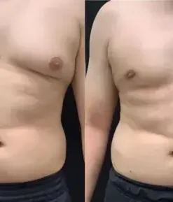 ThermoFirm Bee Venom Oil