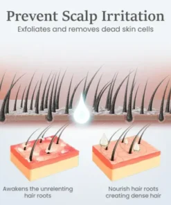 ThickTress Hair Growth Spray