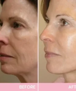 V-Face Lifting Invisible Adhesive Tape