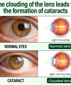 VisionClear Nano Eye Drops